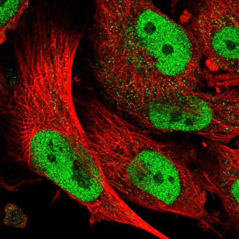 Atlas Antibodies Anti-ABCA1 Antibody