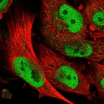 Atlas Antibodies Anti-ABCA1 Antibody