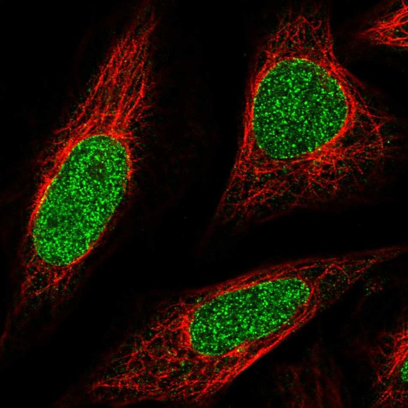 Atlas Antibodies Anti-ABCA5 Antibody