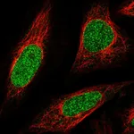 Atlas Antibodies Anti-ABCA5 Antibody