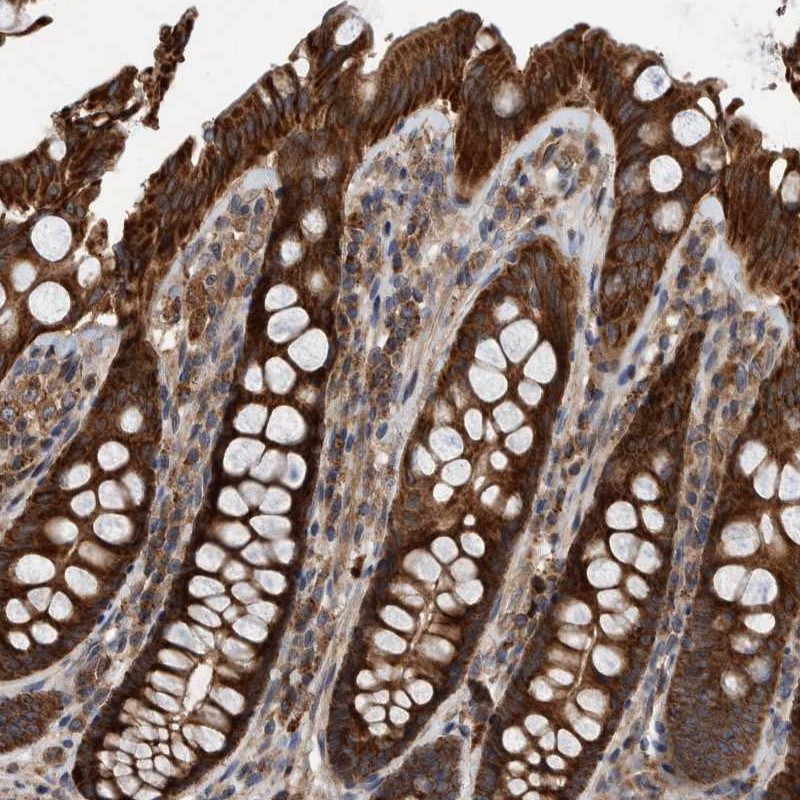 Atlas Antibodies Anti-ABCA5 Antibody