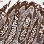 Atlas Antibodies Anti-ABCA5 Antibody