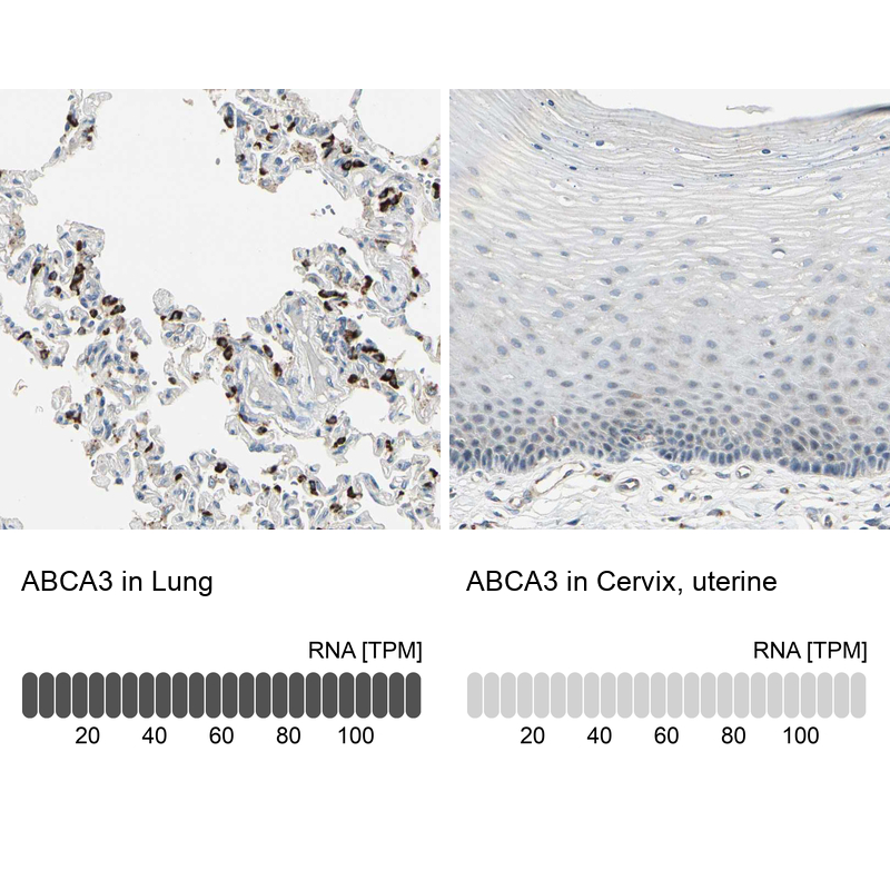 Atlas Antibodies Anti-ABCA3 Antibody