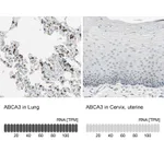 Atlas Antibodies Anti-ABCA3 Antibody