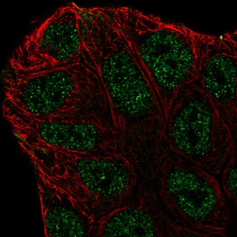 Atlas Antibodies Anti-ABCA6 Antibody