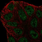 Atlas Antibodies Anti-ABCA6 Antibody