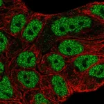 Atlas Antibodies Anti-ABCA6 Antibody