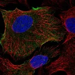 Atlas Antibodies Anti-ABCB1 Antibody