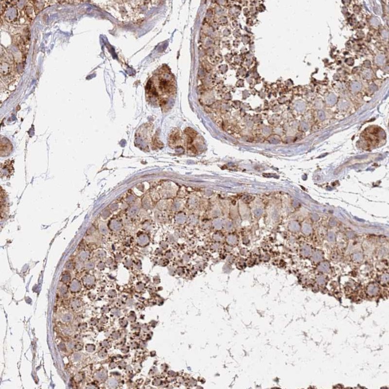 Atlas Antibodies Anti-ABCB6 Antibody