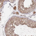 Atlas Antibodies Anti-ABCB6 Antibody