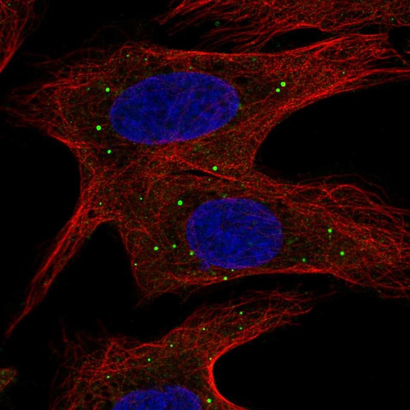 Atlas Antibodies Anti-ABCB9 Antibody