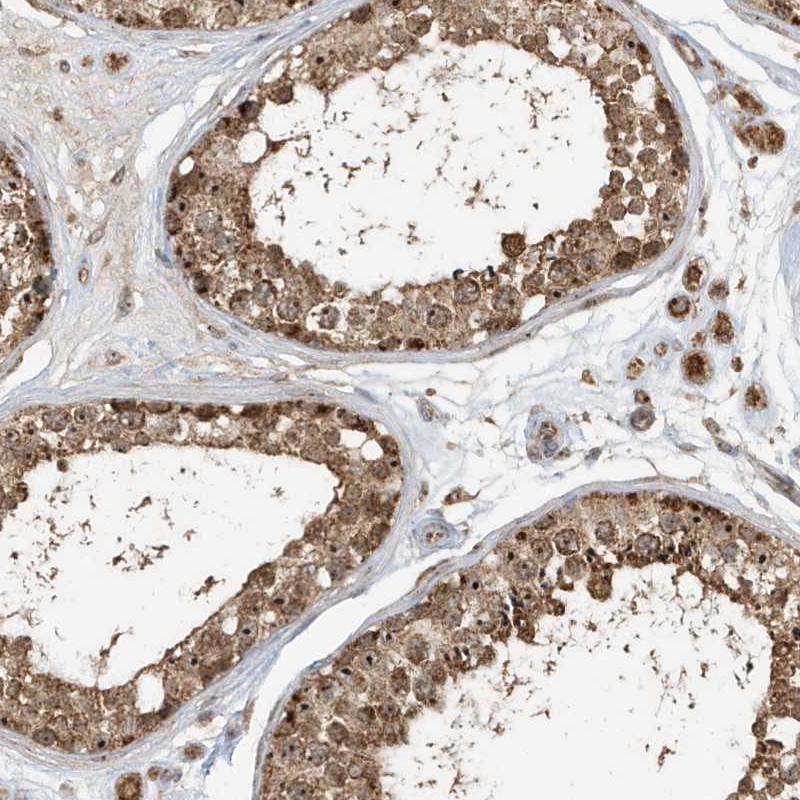 Atlas Antibodies Anti-ABCB9 Antibody