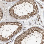 Atlas Antibodies Anti-ABCB9 Antibody