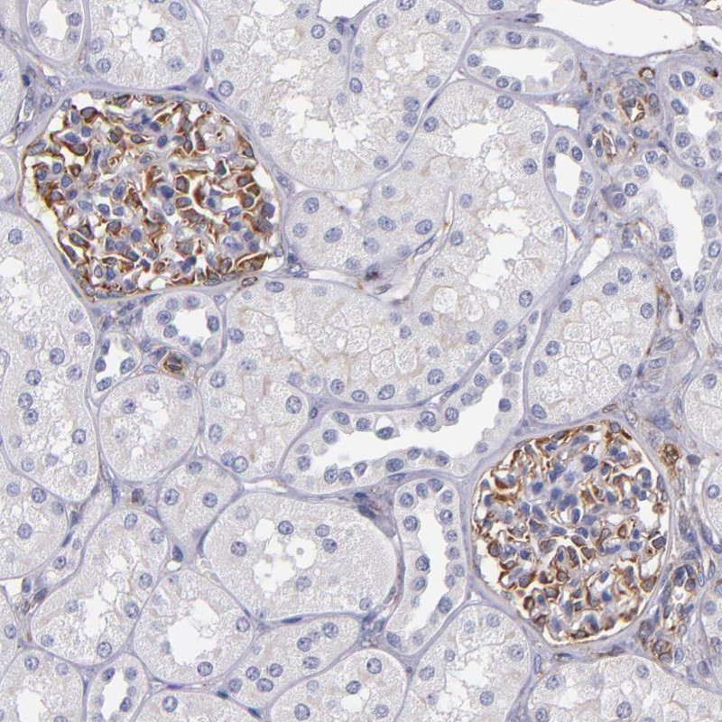 Atlas Antibodies Anti-ABCC1 Antibody
