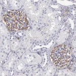 Atlas Antibodies Anti-ABCC1 Antibody