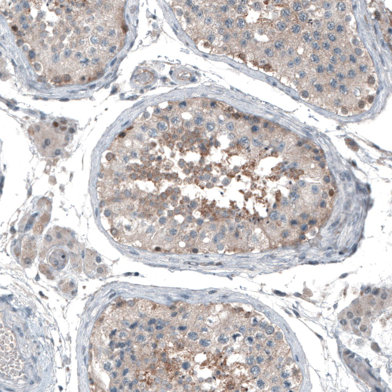 Atlas Antibodies Anti-ABCC11 Antibody