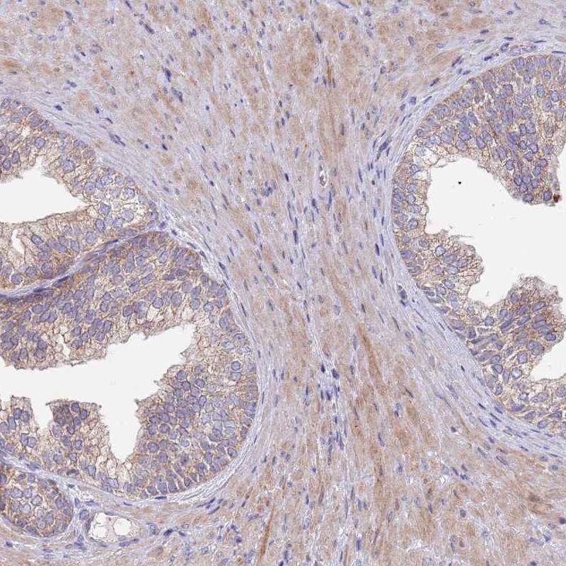 Atlas Antibodies Anti-ABCC10 Antibody