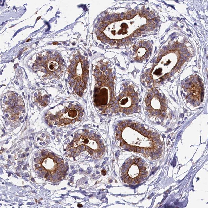 Atlas Antibodies Anti-ABCC10 Antibody
