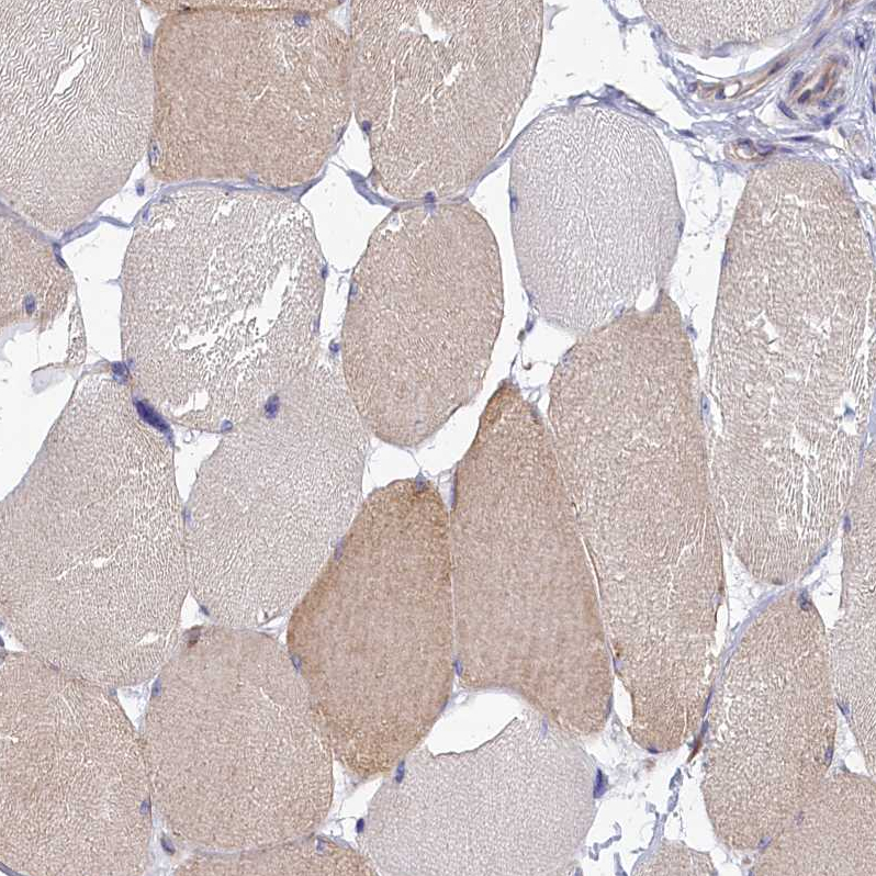 Atlas Antibodies Anti-ABCC12 Antibody