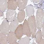 Atlas Antibodies Anti-ABCC12 Antibody