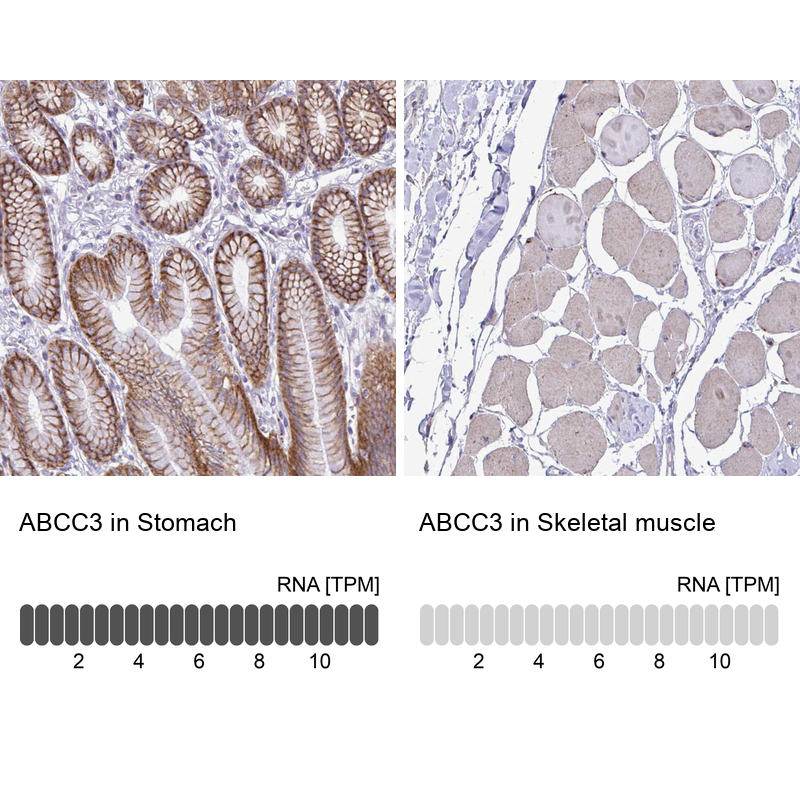 Atlas Antibodies Anti-ABCC3 Antibody