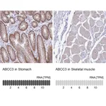 Atlas Antibodies Anti-ABCC3 Antibody