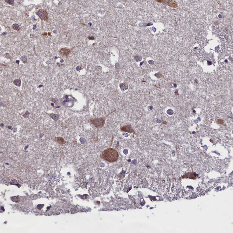 Atlas Antibodies Anti-ABCC8 Antibody