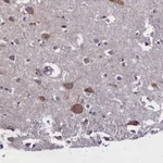 Atlas Antibodies Anti-ABCC8 Antibody