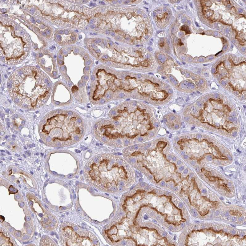 Atlas Antibodies Anti-ABCC5 Antibody