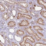 Atlas Antibodies Anti-ABCC5 Antibody