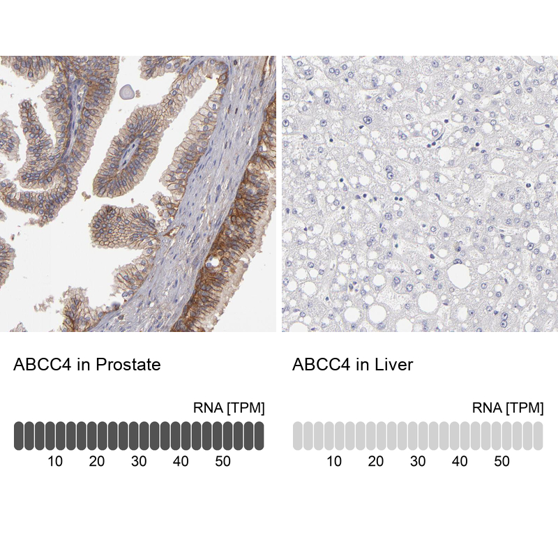 Atlas Antibodies Anti-ABCC4 Antibody
