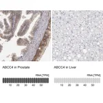 Atlas Antibodies Anti-ABCC4 Antibody