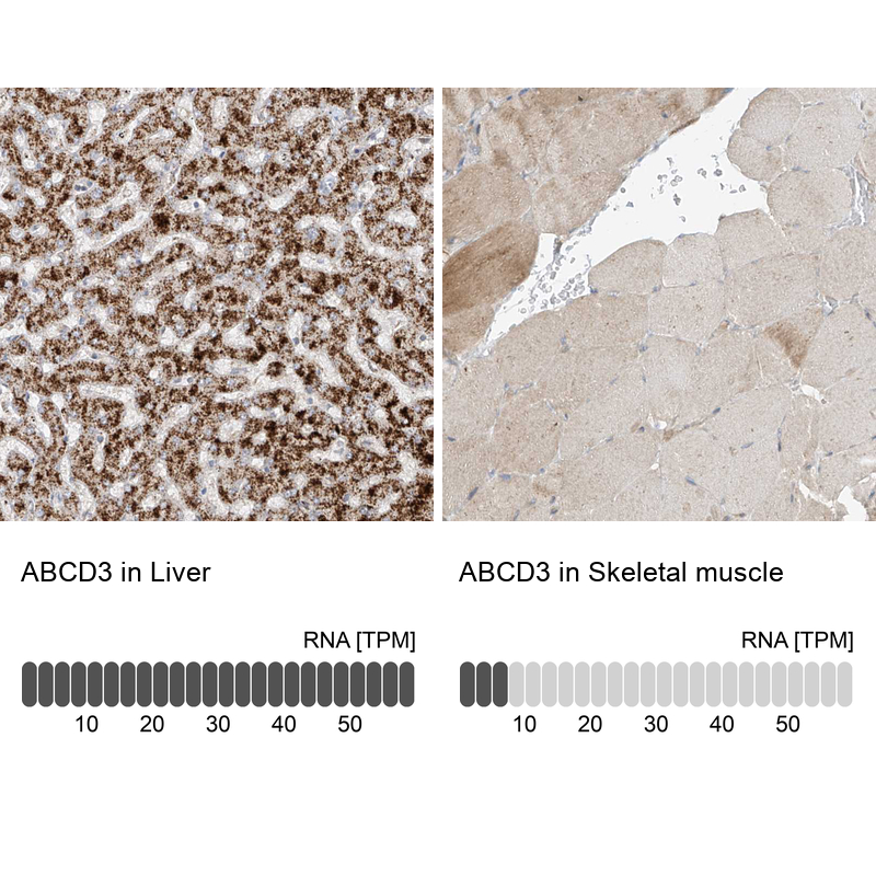 Atlas Antibodies Anti-ABCD3 Antibody
