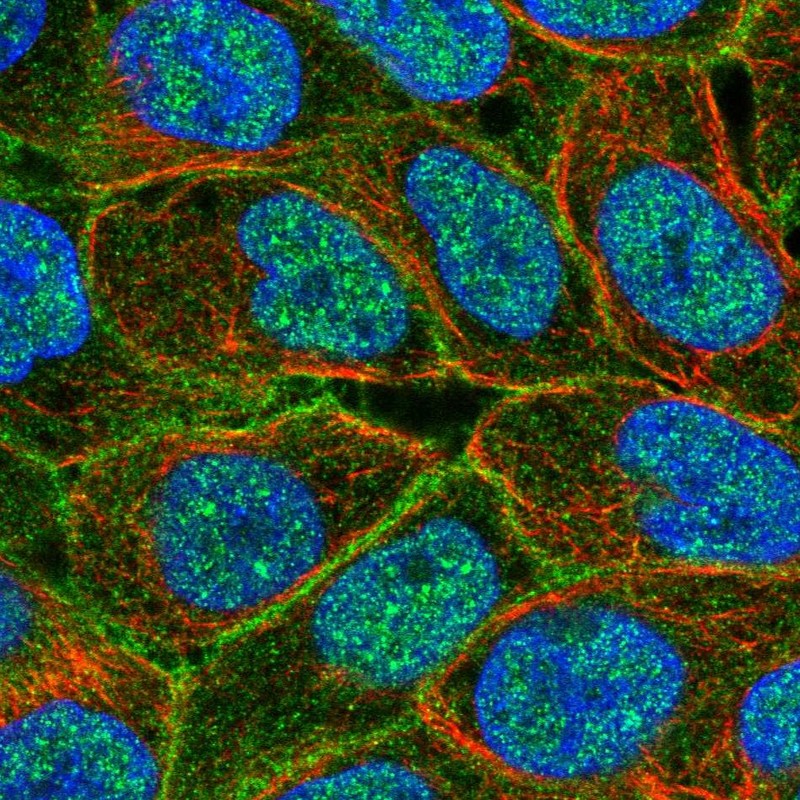 Atlas Antibodies Anti-ABCC5 Antibody