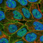 Atlas Antibodies Anti-ABCC5 Antibody