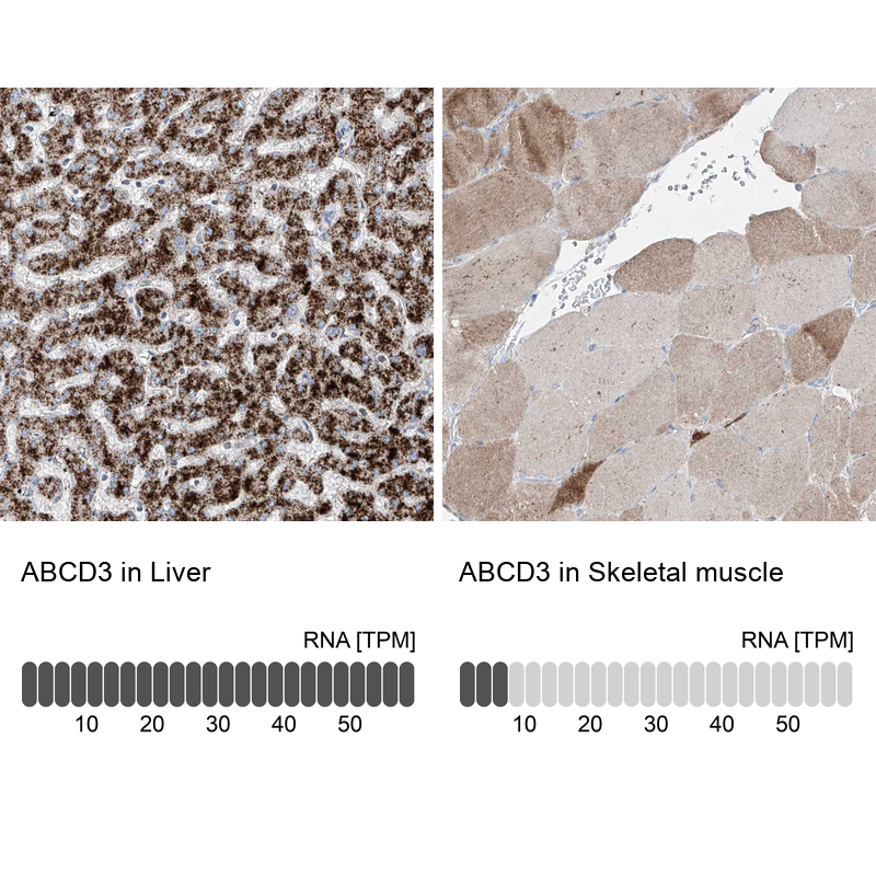 Atlas Antibodies Anti-ABCD3 Antibody