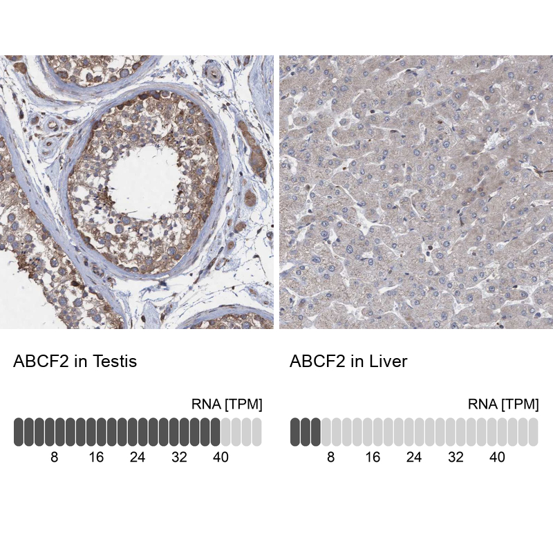 Atlas Antibodies Anti-ABCF2 Antibody