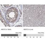 Atlas Antibodies Anti-ABCF2 Antibody