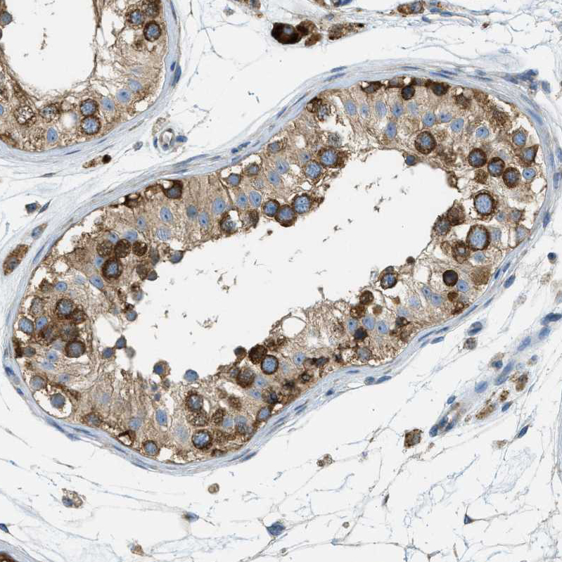 Atlas Antibodies Anti-ABCF1 Antibody