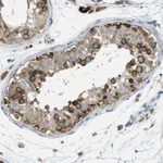 Atlas Antibodies Anti-ABCF1 Antibody