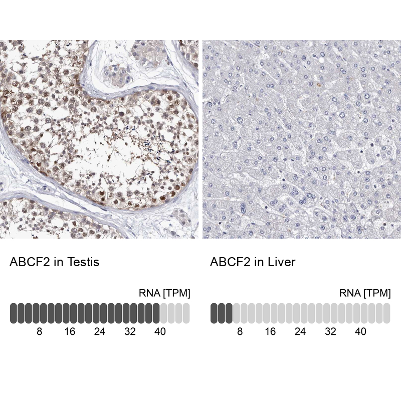 Atlas Antibodies Anti-ABCF2 Antibody