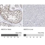 Atlas Antibodies Anti-ABCF2 Antibody