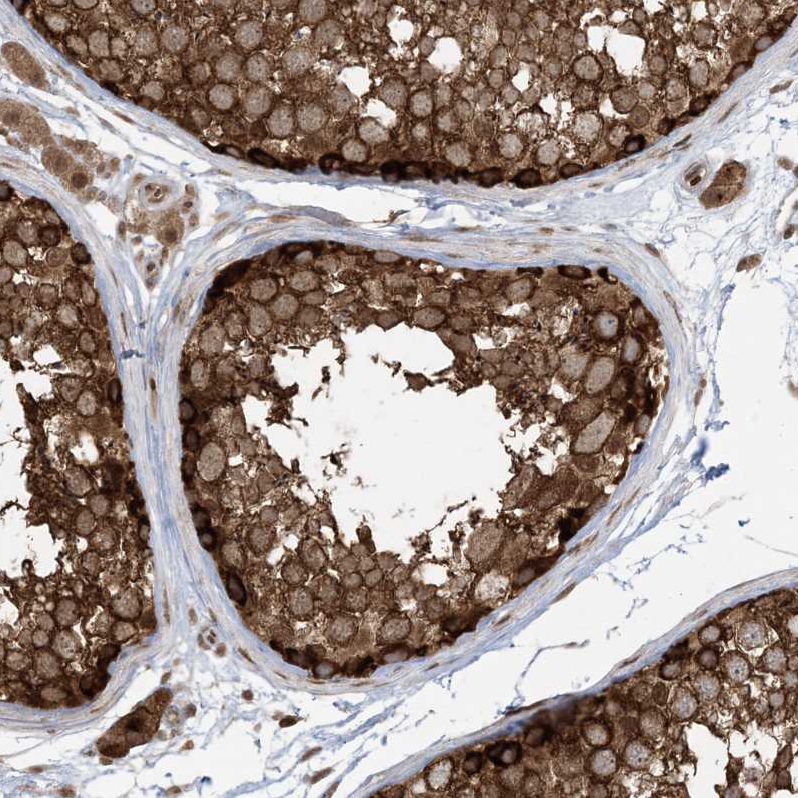 Atlas Antibodies Anti-ABCF3 Antibody