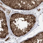 Atlas Antibodies Anti-ABCF3 Antibody