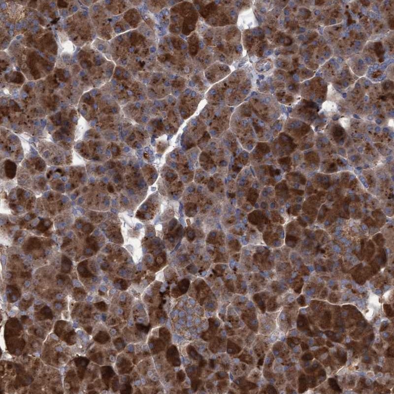 Atlas Antibodies Anti-ABCF2 Antibody