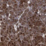 Atlas Antibodies Anti-ABCF2 Antibody