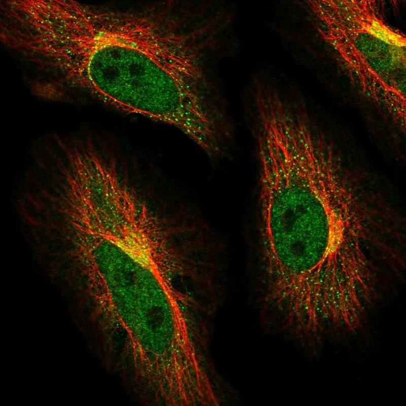 Atlas Antibodies Anti-ABCG1 Antibody
