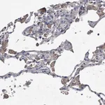 Atlas Antibodies Anti-ABCG1 Antibody
