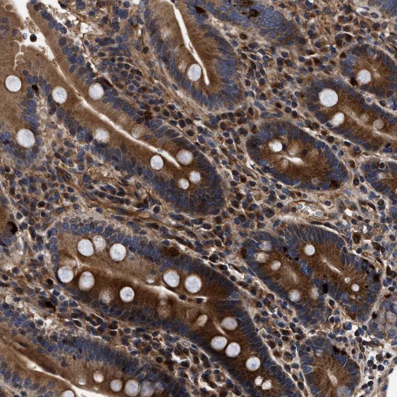 Atlas Antibodies Anti-ABCG8 Antibody
