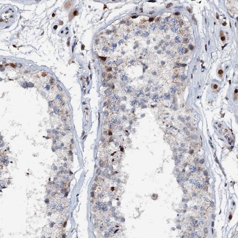 Atlas Antibodies Anti-ABCG4 Antibody